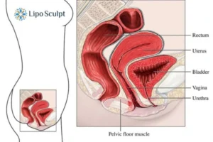 Treatment For A Leaky Bladder 2 How EM Chair treatment Stirling can help Leaky bladder issues. Read more now!