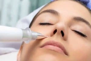 Best Actinic Keratoses Removal 3 Actinic keratoses Stirling solutions - book in today!